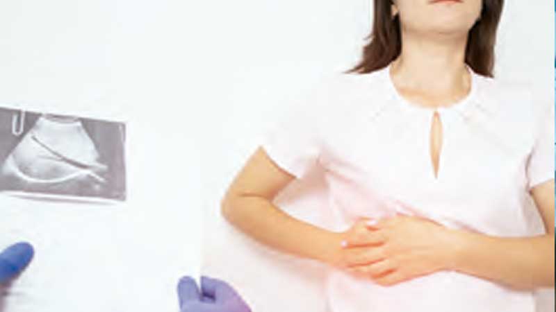 Dismuye los síntomas de lodo biliar en la vesícula