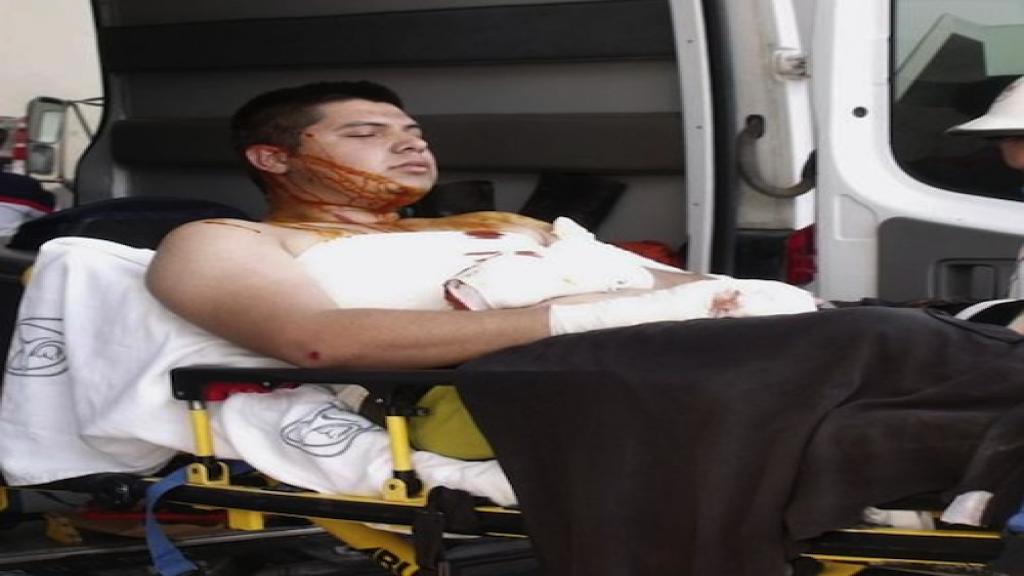 Un trabajador de Pemex es atendido por paramédicos tras la explosión.