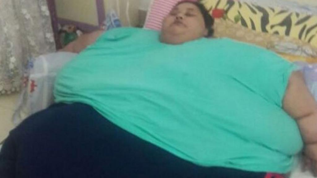 Mujer más obesa del mundo será operada de urgencia ¡para salvar su vida! 