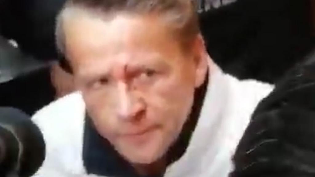 VIDEO: Carlos Trejo le abre la cara de Alfredo Adame y le causa impactante herida 